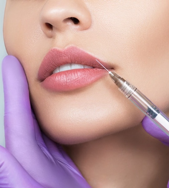 cropped sensual female lips procedure lip augmentation syringe near picture id1188913879 1