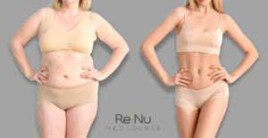 Semaglutide Safe Weight Loss in Los Angeles