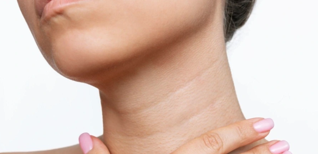How to get rid of neck lines How to get rid of neck lines