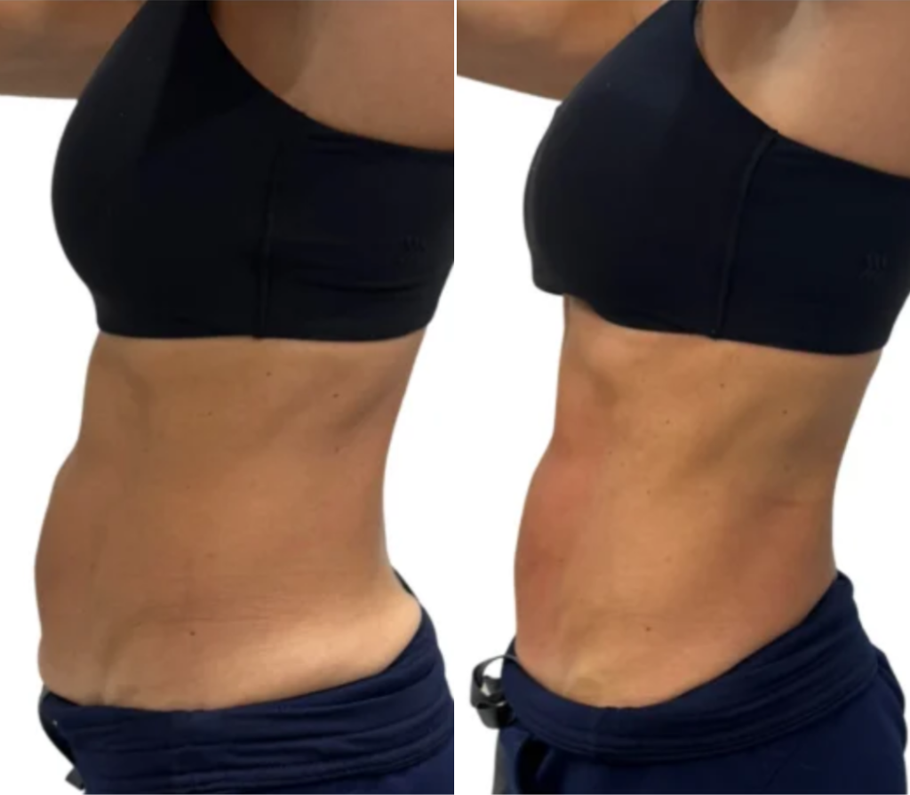 Onda Onda stomach